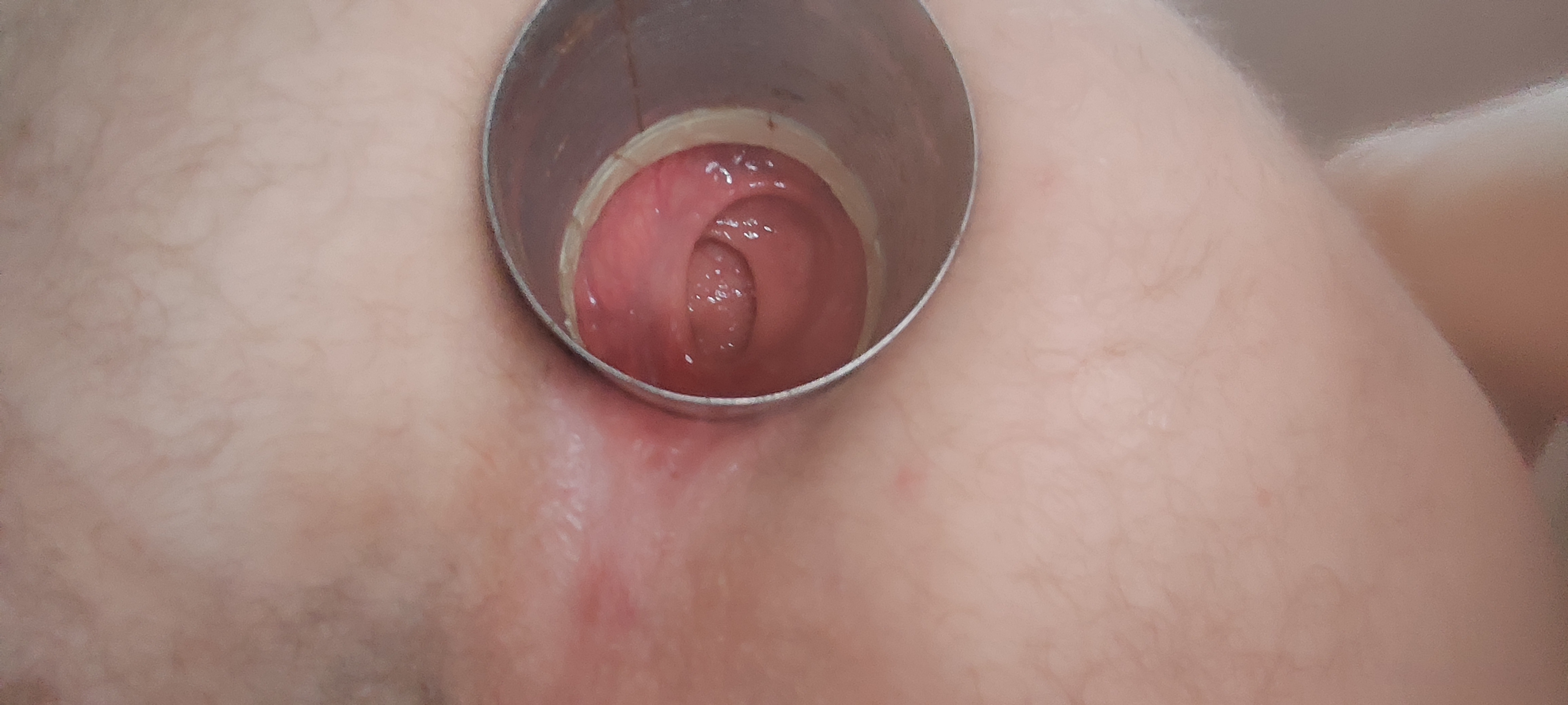 gaping asshole