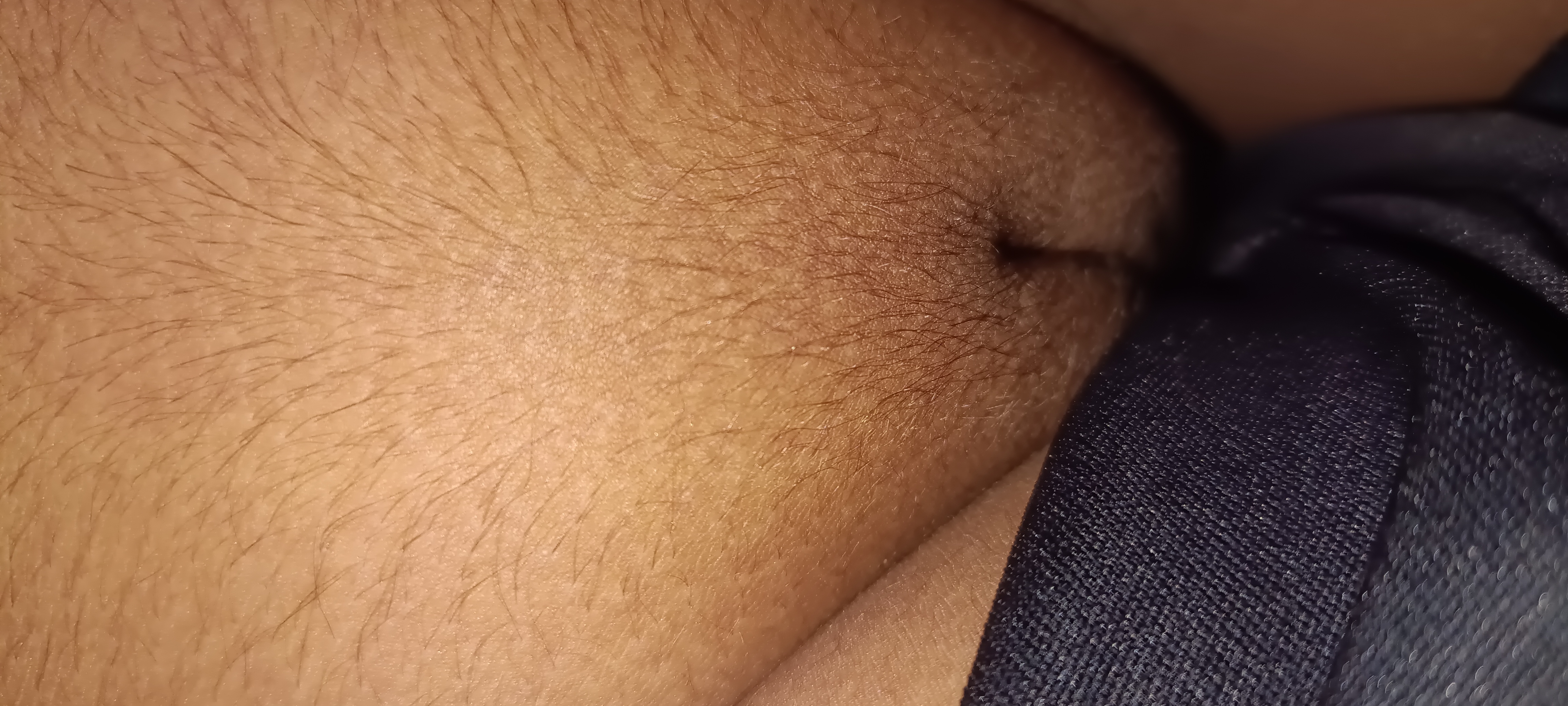Big