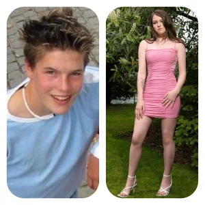 Before and after#3